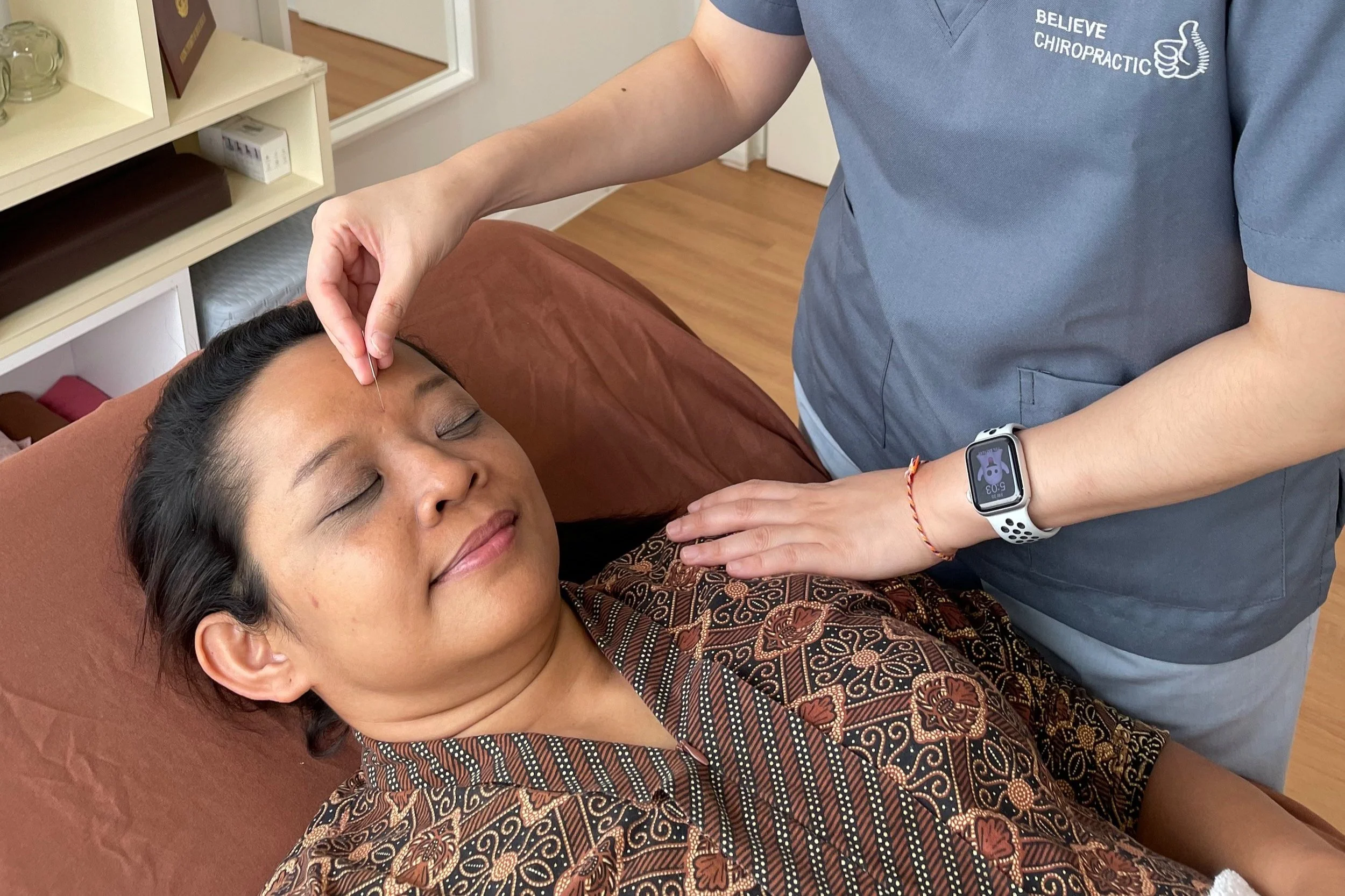 Acupuncture