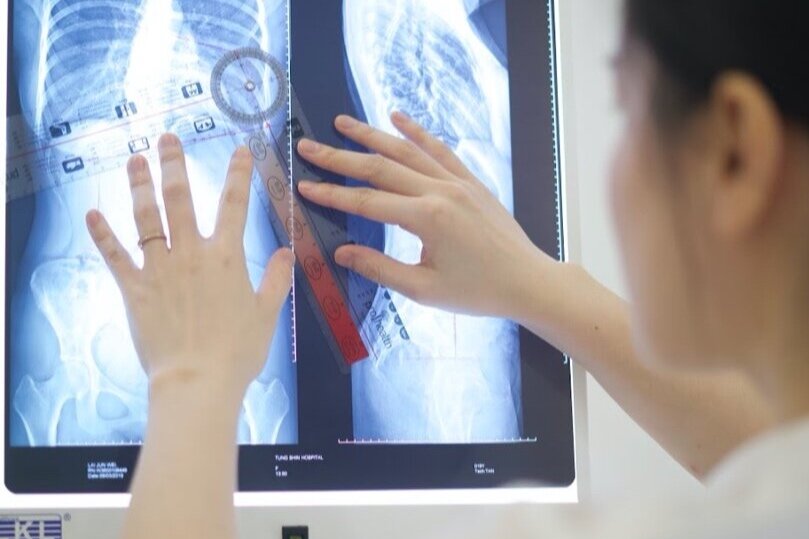 Radiograph Analysis